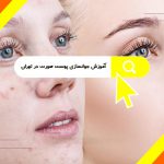 آموزش جوانسازی پوست صورت در تهران