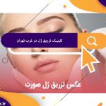 کلینیک تزریق ژل در غرب تهران